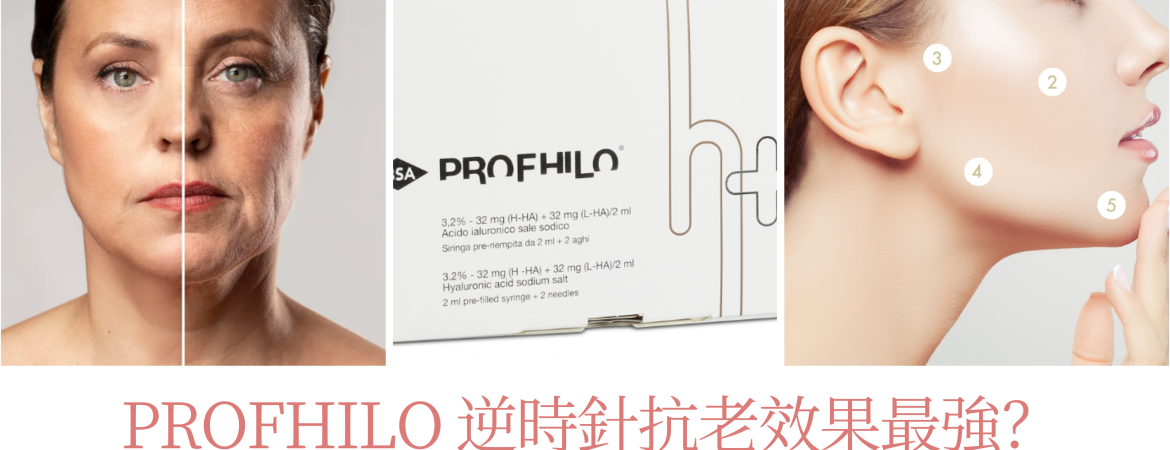 Profhilo逆時針抗老效果最強？一文了解逆時針效果、價錢、護理貼士