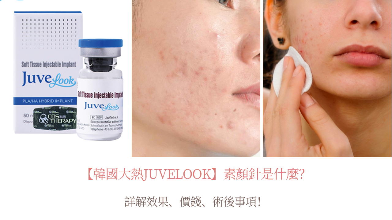 【韓國大熱Juvelook】素顏針是什麼？詳解效果、價錢、術後事項！
